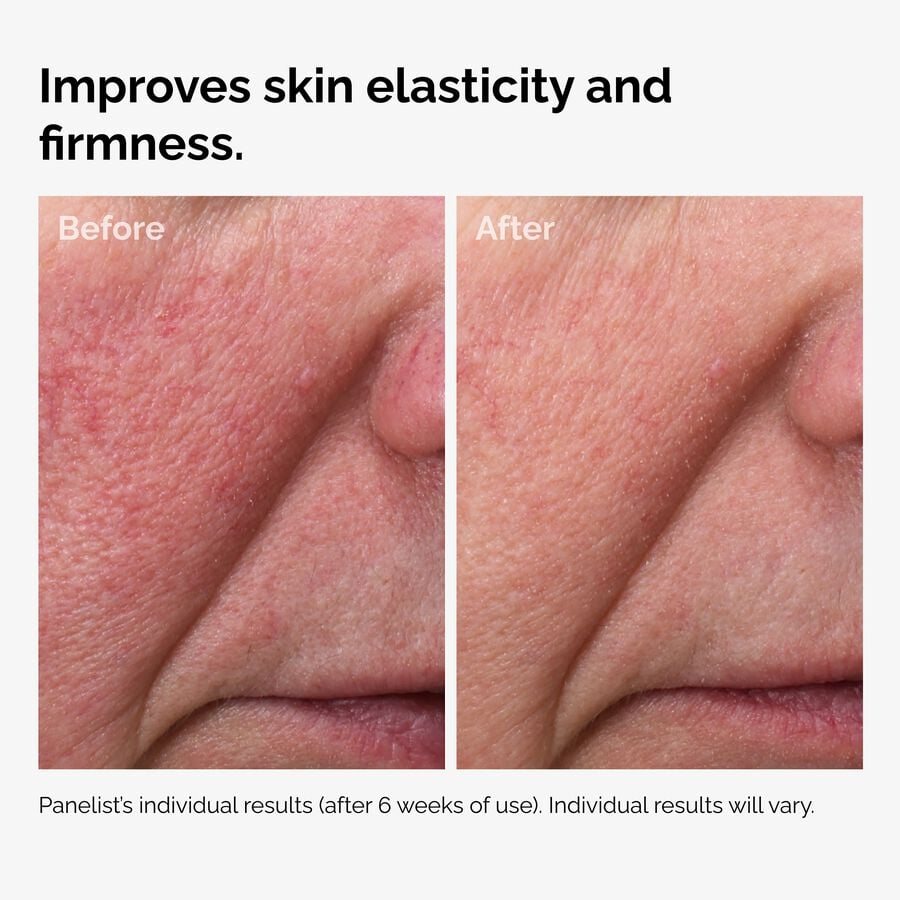 100-fermented-rose-hip-seed-oil-s3 100pct-fermented-rose-hip-before-after-elasticity.jpg