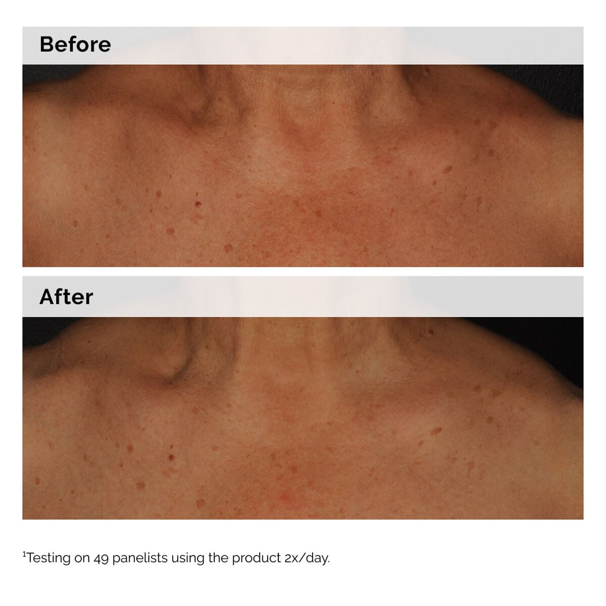 niacinamide-5-face-and-body-emulsion-o0 2024-08-23-ORD-Nia-5pct-Face-Body-B-A-Global-02-1x1.jpg