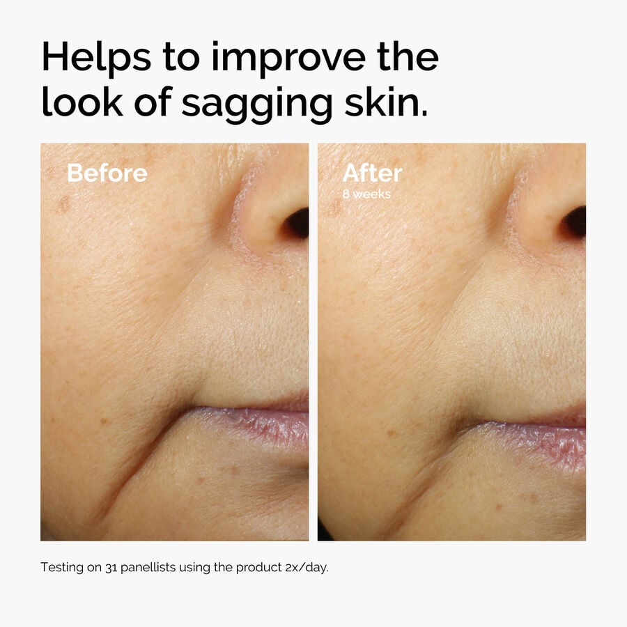 caffeine-3-escin-1-face-serum-m6 ord-caffeine-3pct-escin-1pct-face-serum-before-after-sagging.jpg