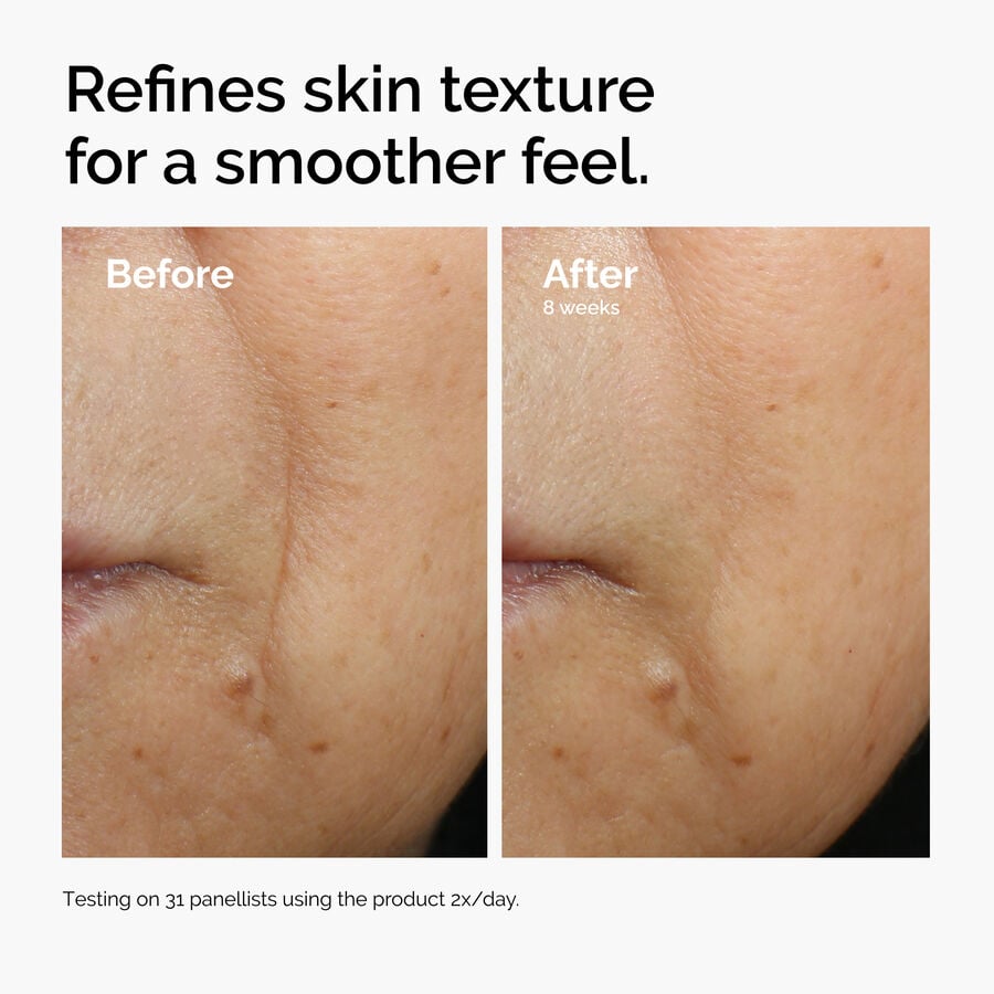 caffeine-3-escin-1-face-serum-m6 ord-caffeine-3pct-escin-1pct-face-serum-before-after-texture.jpg