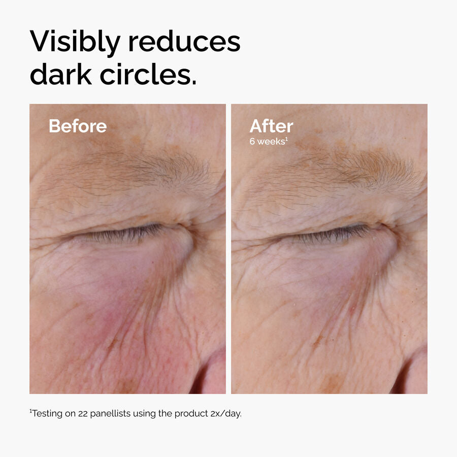 caffeine-solution-5-egcg-eye-serum-q6 ord-caffeine-solution-egcg-dark-circles-before-after.jpg