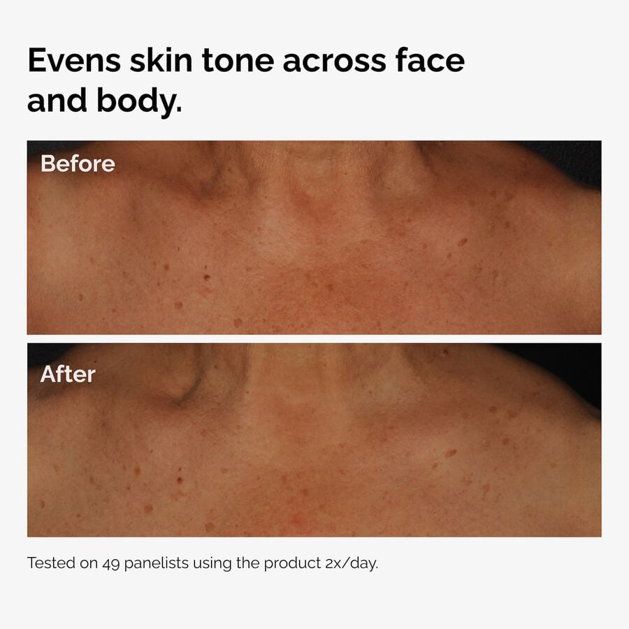 the-body-care-collection-x5 ord-niacinamide-face-body-serum-before-after-even-tone-graphic.jpg