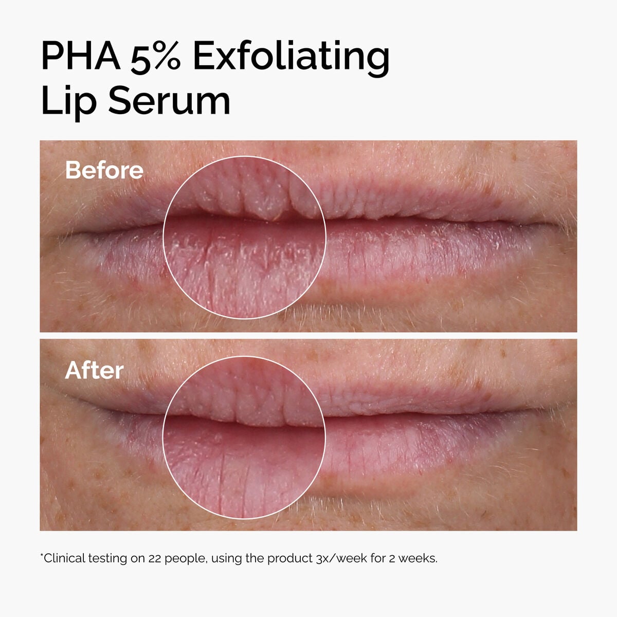 pha-5-exfoliating-lip-serum-v0 ord-pha-5pct-lip-exfoliating-serum-before-after.jpg