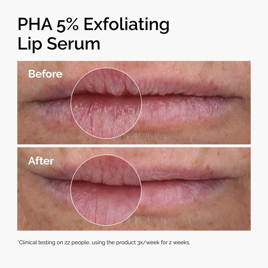 pha-5-exfoliating-lip-serum-v0 ord-pha-5pct-lip-exfoliating-serum-before-after.jpg