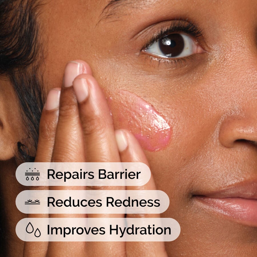 soothing-and-barrier-support-serum-q2 ord-soothing-barrier-support-serum-model-application-with-benefits.jpg