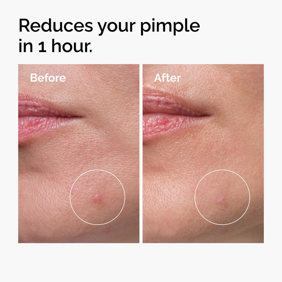 sulfur-10-powder-to-cream-concentrate-n2 ord-sulfur-10pct-powder-to-cream-concentrate-before-after-NA.jpg